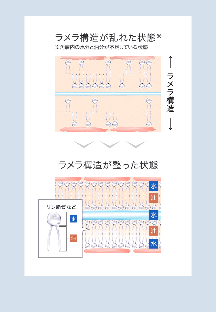 ラメラ構造の正常状態と乱れの比較図｜肌トラブルの原因と改善イメージ